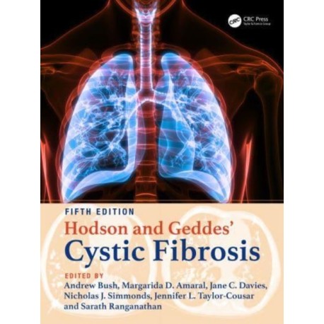 Hodson and Geddes' Cystic Fibrosis