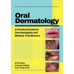 Oral Dermatology: A practical guide for dermatologists and medical practitioners