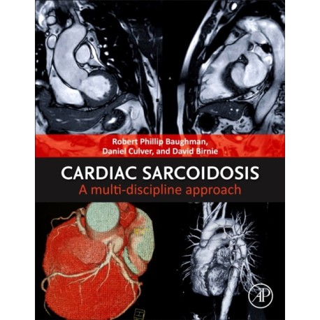 Cardiac Sarcoidosis: A Multi-discipline Approach