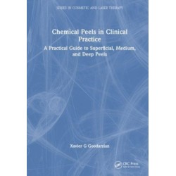 Chemical Peels in Clinical Practice: A Practical Guide to Superficial, Medium, and Deep Peels