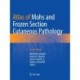 Atlas of Mohs and Frozen Section Cutaneous Pathology