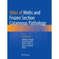 Atlas of Mohs and Frozen Section Cutaneous Pathology