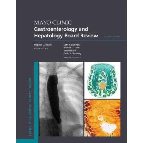 Mayo Clinic Gastroenterology and Hepatology Board Review