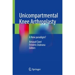 Unicompartmental Knee Arthroplasty: A New Paradigm?