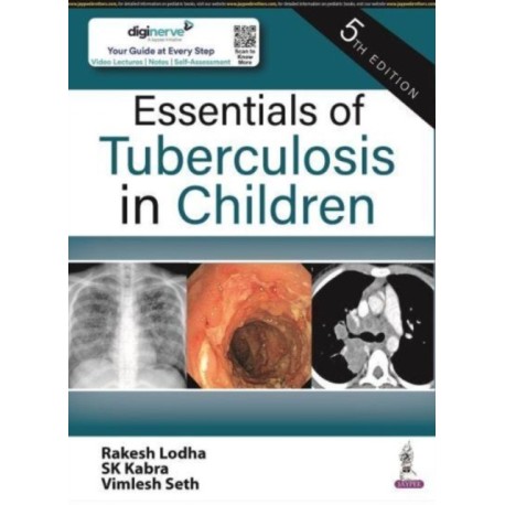 Essentials of Tuberculosis in Children