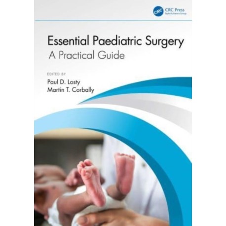 Essential Paediatric Surgery: A Practical Guide