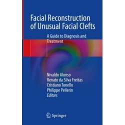 Facial Reconstruction of Unusual Facial Clefts: A Guide to Diagnosis and Treatment