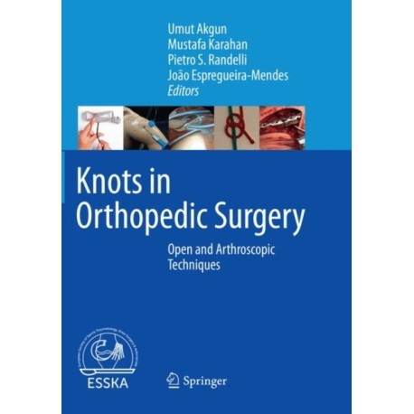 Knots in Orthopedic Surgery: Open and Arthroscopic Techniques