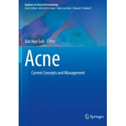 Acne: Current Concepts and Management