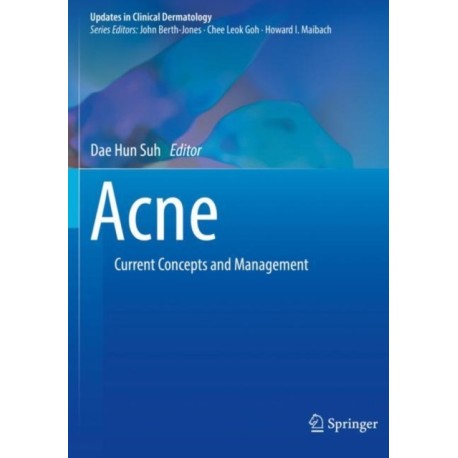 Acne: Current Concepts and Management