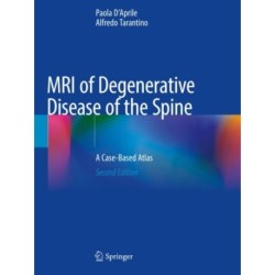 MRI of Degenerative Disease of the Spine: A Case-Based Atlas