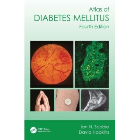 Atlas of Diabetes Mellitus
