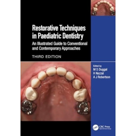 Restorative Techniques in Paediatric Dentistry: An Illustrated Guide to Conventional and Contemporary Approaches