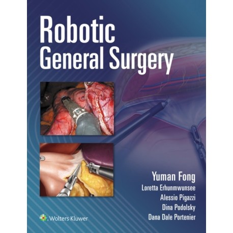 Robotic General Surgery