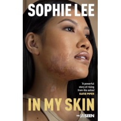 In My Skin: Learning to love your perfectly imperfect life
