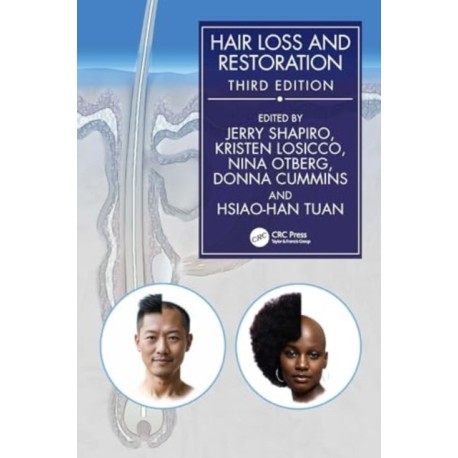 Hair Loss and Restoration