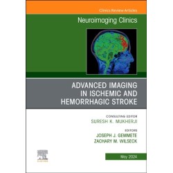 Advanced Imaging in Ischemic and Hemorrhagic Stroke, An Issue of Neuroimaging Clinics of North America
