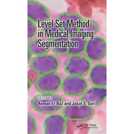 Level Set Method in Medical Imaging Segmentation