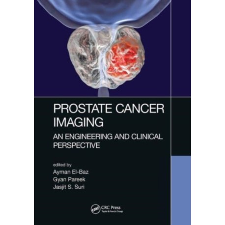Prostate Cancer Imaging: An Engineering and Clinical Perspective
