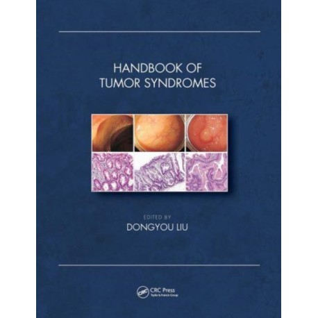Handbook of Tumor Syndromes