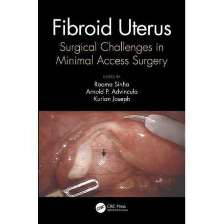 Fibroid Uterus: Surgical Challenges in Minimal Access Surgery