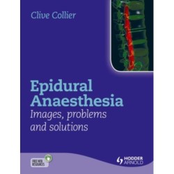 Epidural Anaesthesia: Images, Problems and Solutions