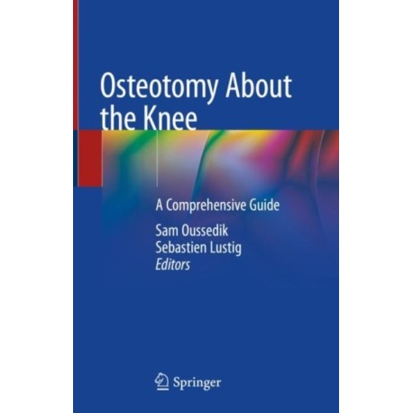 Osteotomy About the Knee: A Comprehensive Guide