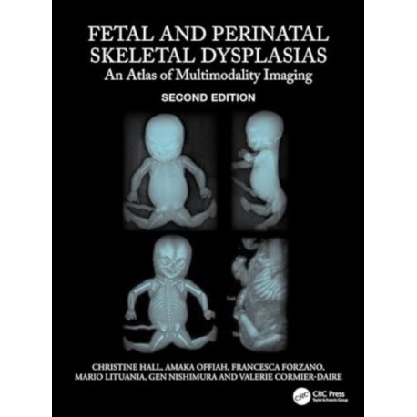 Fetal and Perinatal Skeletal Dysplasias: An Atlas of Multimodality Imaging