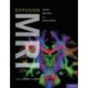 Diffusion MRI: Theory, Methods, and Applications