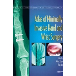 Atlas of Minimally Invasive Hand and Wrist Surgery