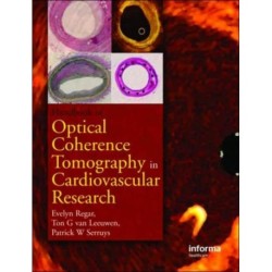 Optical Coherence Tomography in Cardiovascular Research