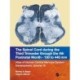 The Spinal Cord during the Middle Second Trimester through the 4th Postnatal Month 130- to 440-mm Crown-Rump Lengths: Atlas of Human Central Nervous System Development, Volume 15