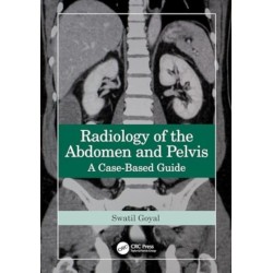 Radiology of the Abdomen and Pelvis: A Case-Based Guide