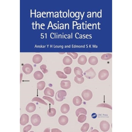 Haematology and the Asian Patient: 51 Clinical Cases