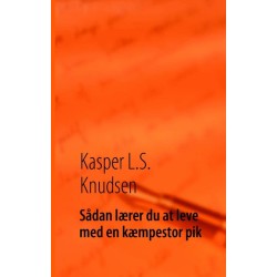 Sådan lærer du at leve med en kæmpestor pik