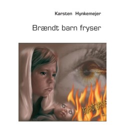 Brændt barn fryser