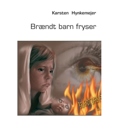 Brændt barn fryser