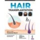 Hair Transplantation