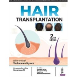 Hair Transplantation
