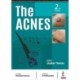 The Acnes
