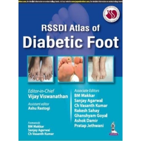 RSSDI Atlas of Diabetic Foot