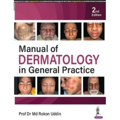 Manual of Dermatology in General Practice