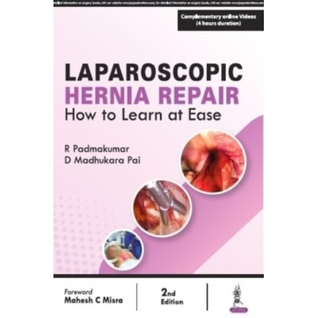 Laparoscopic Hernia Repair: How to Learn at Ease
