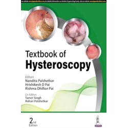 Textbook of Hysteroscopy