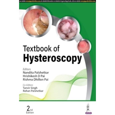 Textbook of Hysteroscopy