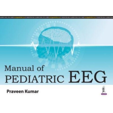 Manual of Pediatric EEG