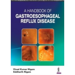 A Handbook of Gastroesophageal Reflux Disease (GERD)