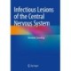 Infectious Lesions of the Central Nervous System
