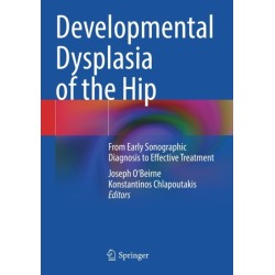 Developmental Dysplasia of the Hip: From Early Sonographic Diagnosis to Effective Treatment