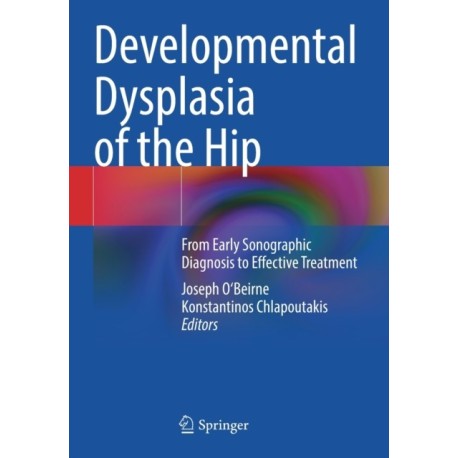 Developmental Dysplasia of the Hip: From Early Sonographic Diagnosis to Effective Treatment
